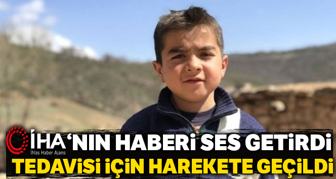 Küçük Ahmet’in tedavisi için harekete geçildi