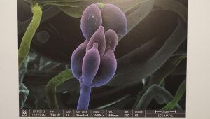 Taramalı Elektron Mikroskopu ile görüntülendi