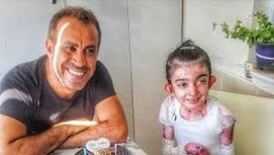 'Kelebek çocuk' Elfida, hayatını kaybetti