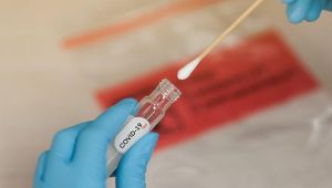 EBSO’nun Covid-19 antikor testi uygulaması devam ediyor 