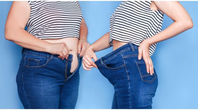 Obeziteyi Rehabilitasyona Alın