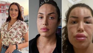 Gençleşmek isterken hayatı karardı