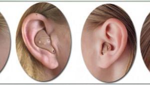 En İyi İşitme Cihazı