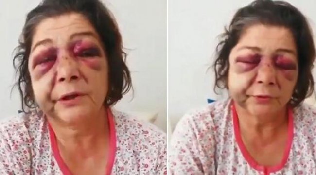 'Bakımsız park' tartışmasında oğlu ve gelini ile birlikte darbedildi