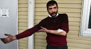 Gaziantep'te pitbull cinsi köpeğin saldırdığı kişi yaralandı