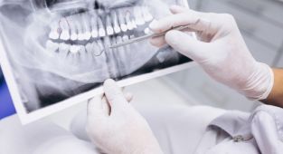 Sigara, diş tedavi sürecini olumsuz etkiliyor