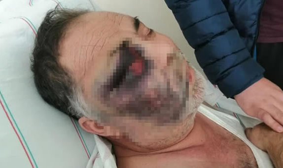 Engelli eşini döverek öldürmekle suçlanan baba ve oğlun beraatına isyan etti