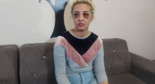 Eski sevgilisini feci şekilde dövüp, '2 saat uyuyalım, gideceğim' demiş