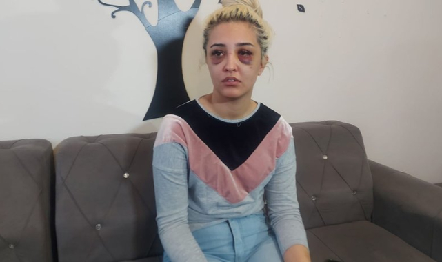 Eski sevgilisini feci şekilde dövüp, '2 saat uyuyalım, gideceğim' demiş