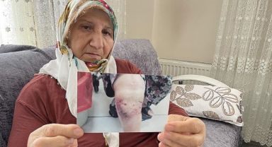 İzmir'de 3 yıl önce köpek saldırısına uğrayan kadın hukuk mücadelesinde kararlı
